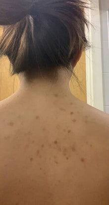 Before - Era lo que necesitaba