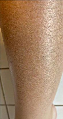 Before - Mejoró mi seguridad